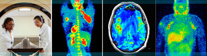 Diagnostic Imaging - The Role of Medical Imaging in Cancer Detection