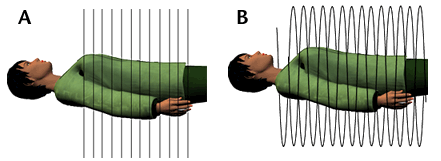 Conventional CT scan, and a spiral CT scan.