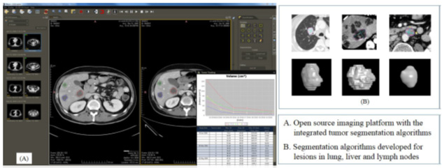 A response assessment platform for development and validation of imaging biomarkers in oncology